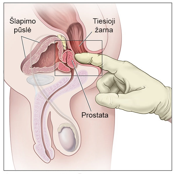 Prostate Gear stiklinis prostatos masažuoklis Maxi